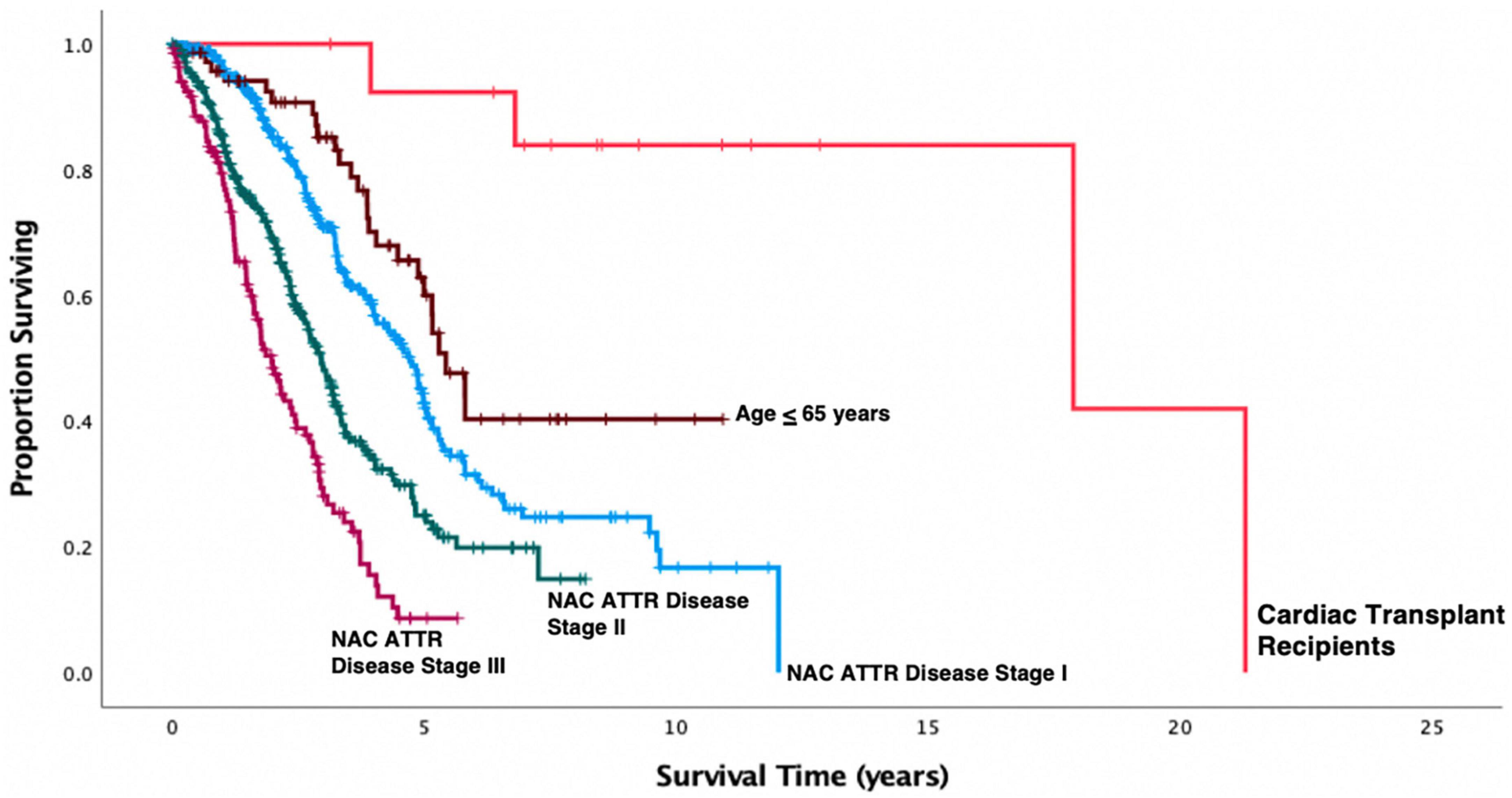 Cardiac transplantation in transthyretin amyloid cardiomyopathy: Outcomes from three decades of tertiary center experience